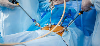 Hospital for Laparoscopic Surgery